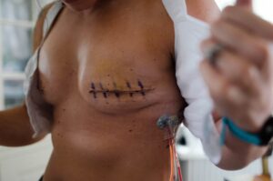 Oxigenoterapia Hiperbárica: O Guia Completo para Cicatrização Acelerada em Rondonópolis-MT